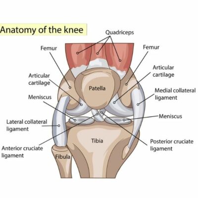 Posterolateral Corner Injury of the Knee